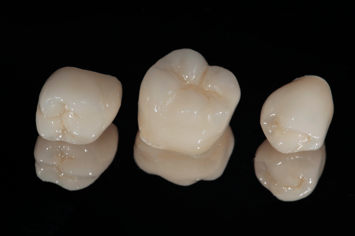 Dental crowns in Winchester at Parchment Street Dental