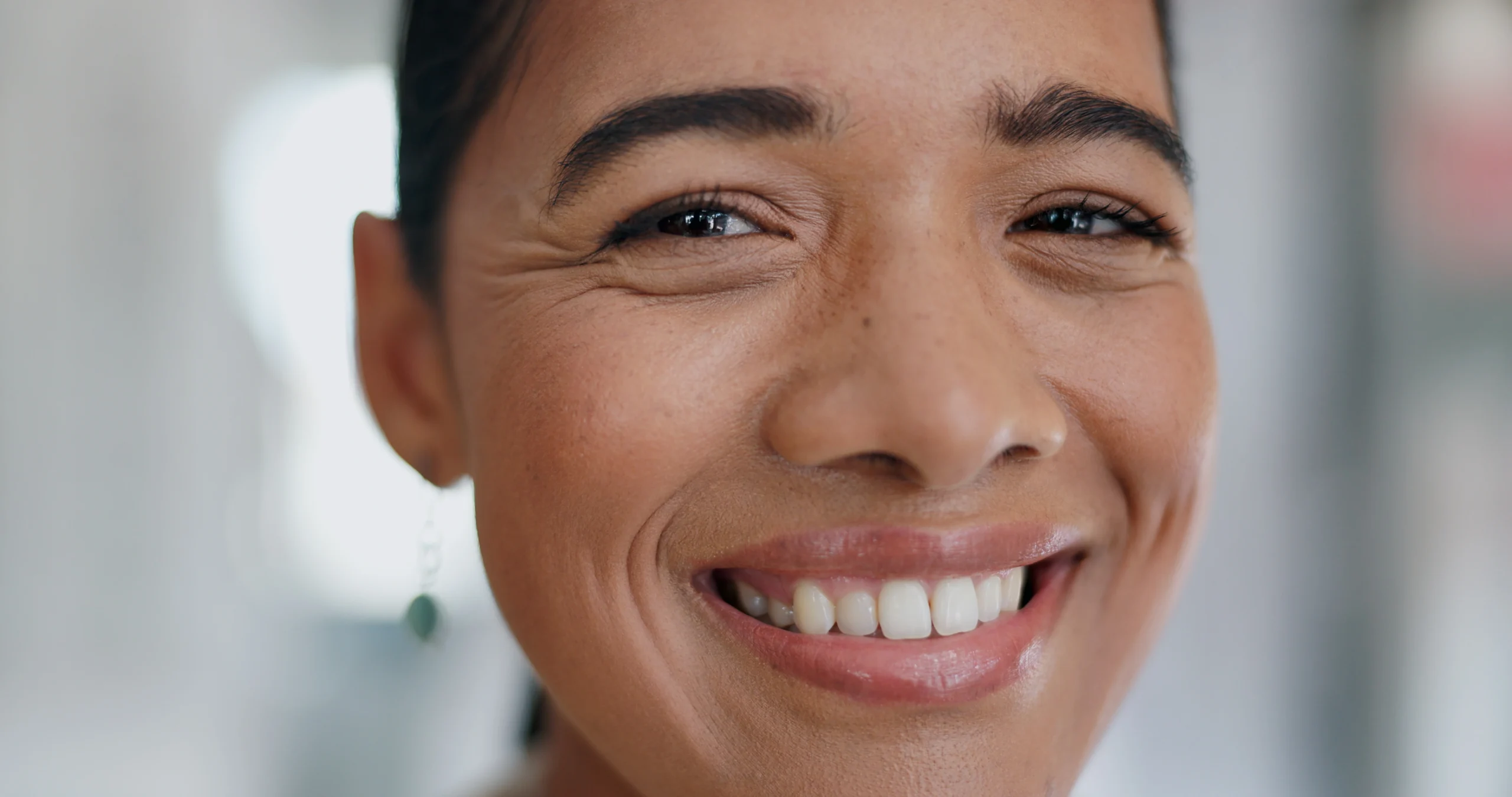 Dental crowns at Parchment Street Dental Winchester