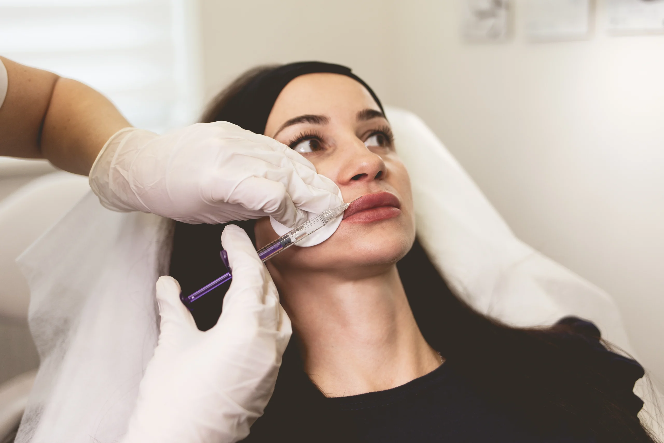 Lip fillers in Winchester at Parchment Street Dental
