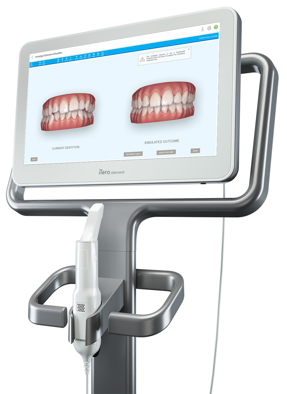 iTero® Element scanner at Parchment Street Dental Winchester