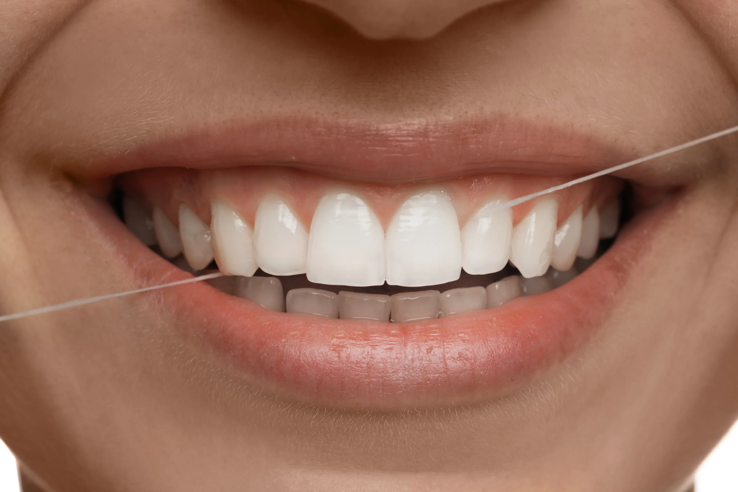 Gum health maintenance at Parchment Street Dental Winchester