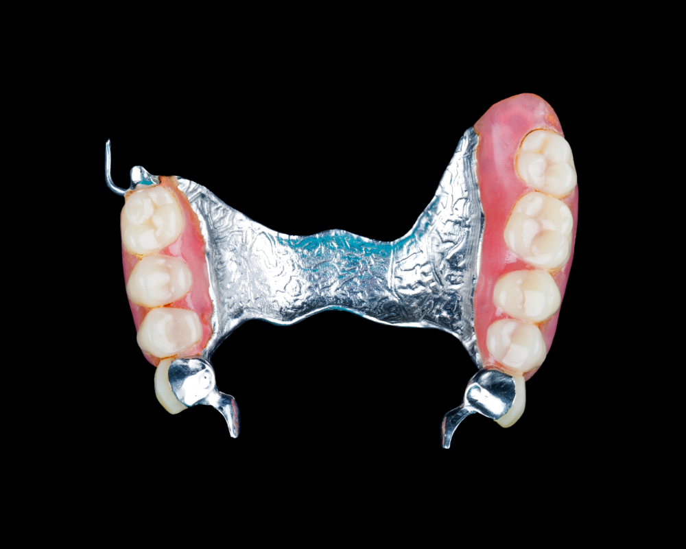 Partial chrome cobalt denture